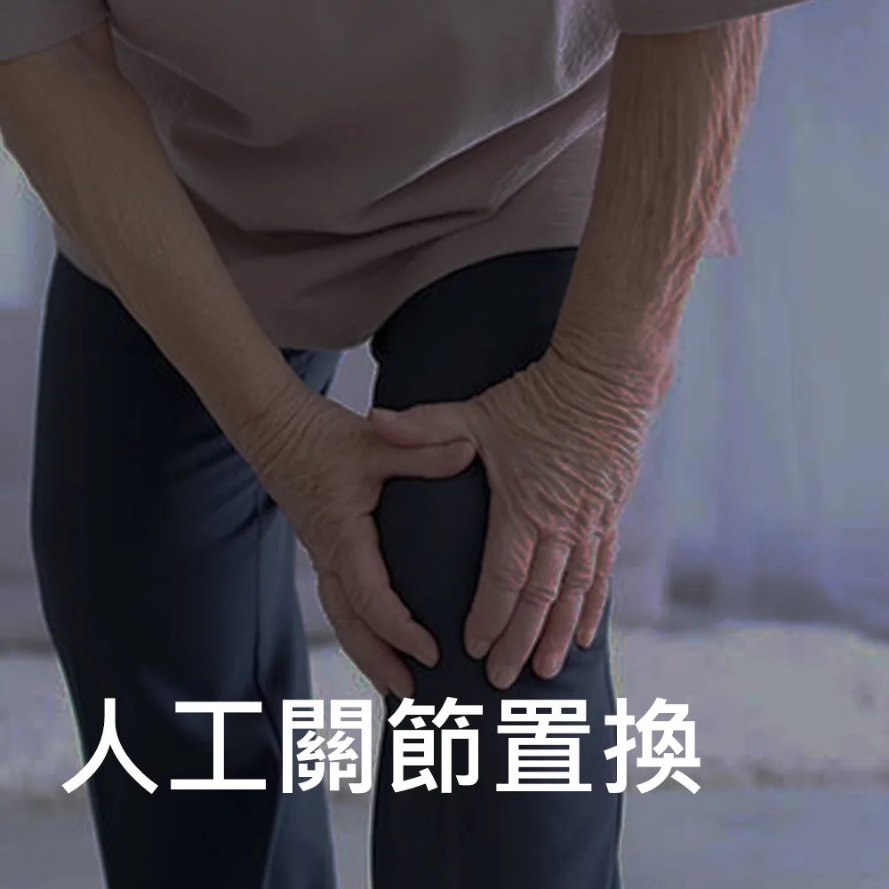 關節置換