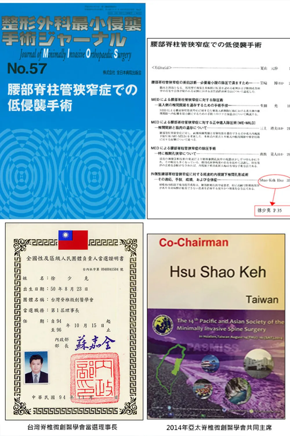 恭賀 徐少克醫師 徐少克主任接受日本脊椎微創醫學會邀請發表論文至日本脊椎微創雜誌